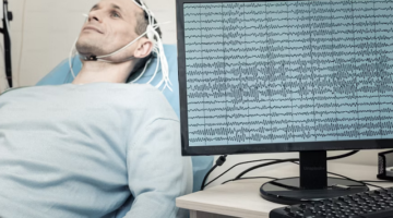 EEG findings